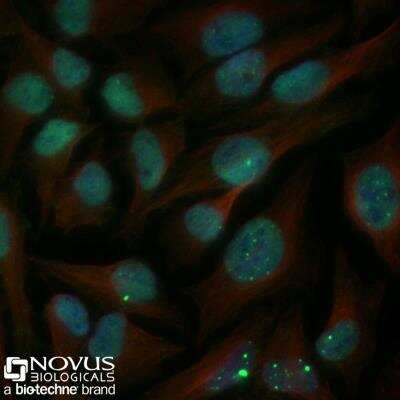 Immunocytochemistry/Immunofluorescence Staining of 53BP1 in A431 Cells Using Conjugated Antibody